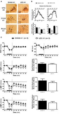 Medullary Noradrenergic Neurons Mediate Hemodynamic Responses to Osmotic and Volume Challenges